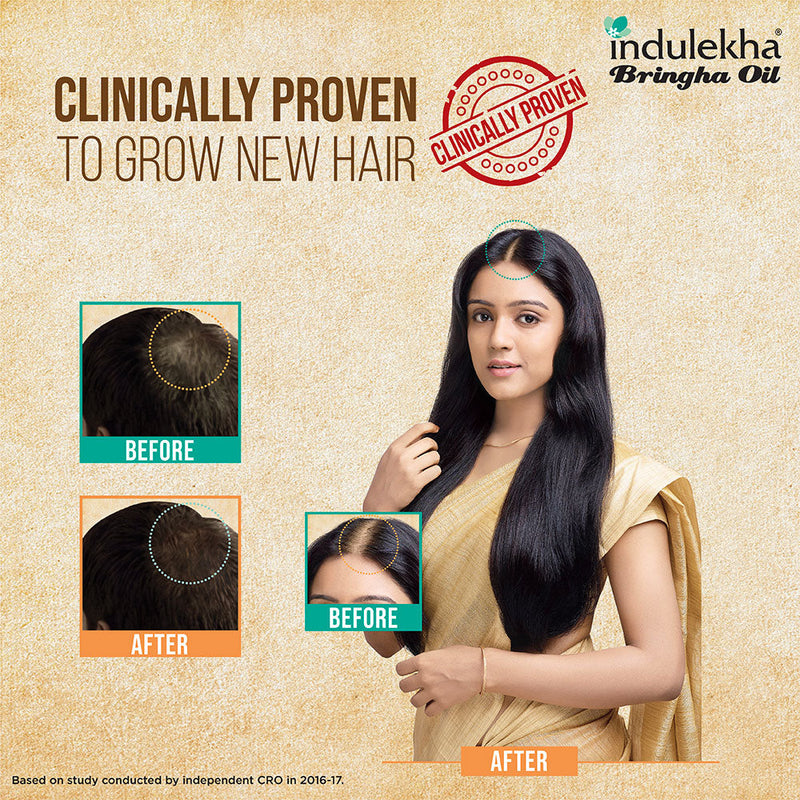 Indulekha Bringha Oil, Reduces Hair Fall and Grows New Hair, 100% Ayurvedic Oil, 100ml and Indulekha Bringha Shampoo, Proprietary Ayurvedic Medicine for Hairfall, 340ml(Combo Pack)